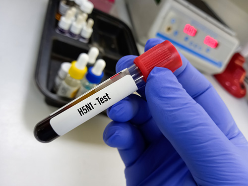 Gloved hand holding H5N1 blood test vial