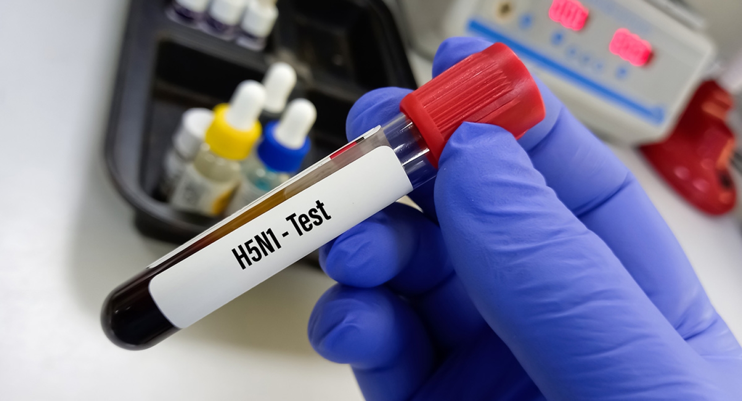 Gloved hand holding H5N1 blood test sample